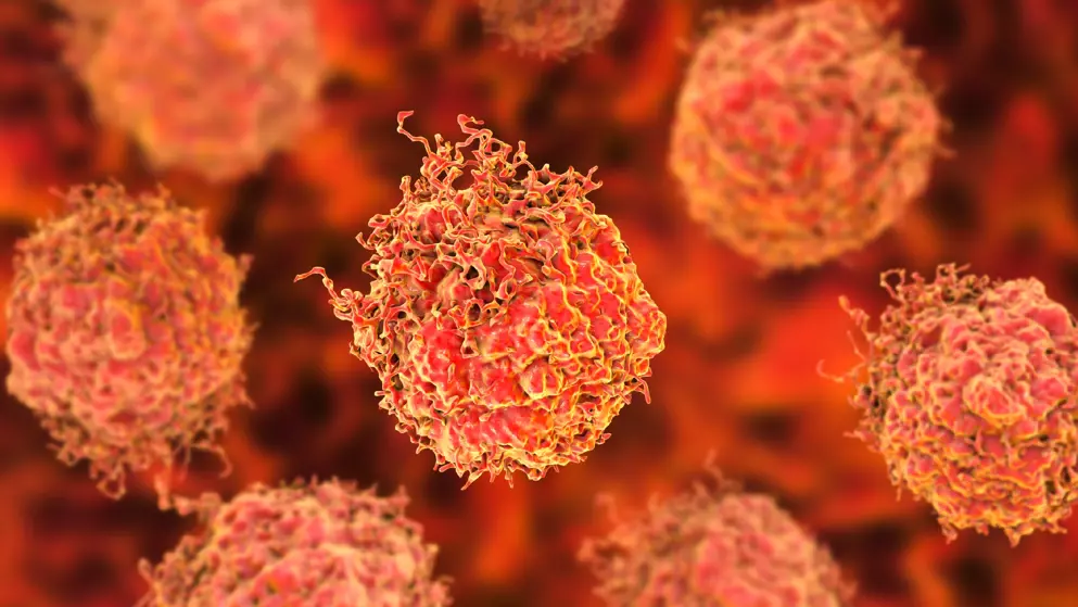 Prostate cancer cells, 3D illustration. Prostate cancer awareness image