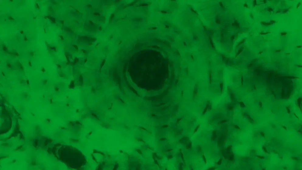 Non-specific human tissue micrograph rendered in green