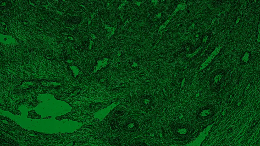 Non-specific human tissue micrograph rendered in green